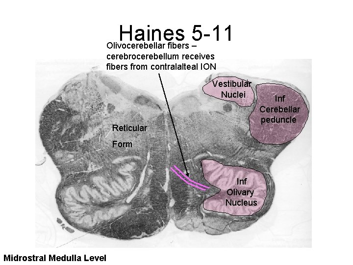 Haines 5 -11 Olivocerebellar fibers – cerebrocerebellum receives fibers from contralalteal ION Vestibular Nuclei