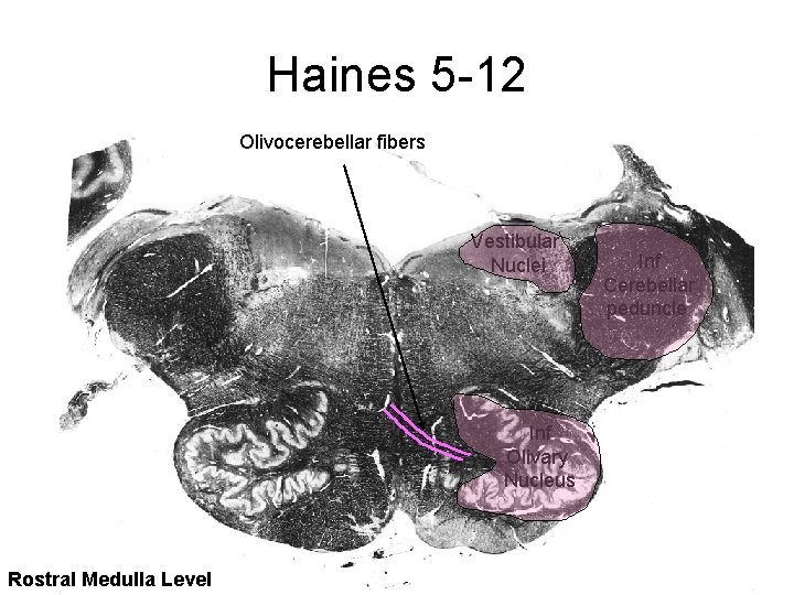 Haines 5 -12 Olivocerebellar fibers Vestibular Nuclei Inf Olivary Nucleus Rostral Medulla Level Inf