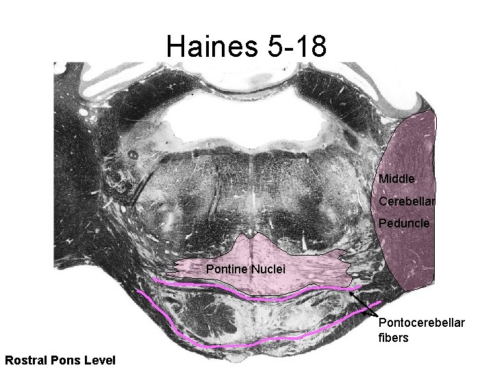 Haines 5 -18 Middle Cerebellar Peduncle Pontine Nuclei Pontocerebellar fibers Rostral Pons Level 