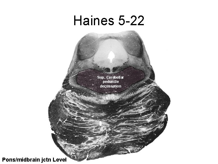Haines 5 -22 Sup. Cerebellar peduncle decussation Pons/midbrain jctn Level 
