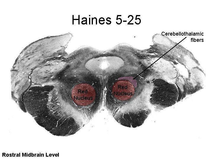 Haines 5 -25 Cerebellothalamic fibers Red Nucleus Rostral Midbrain Level Red Nucleus 