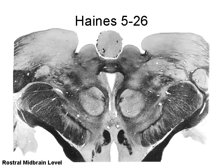 Haines 5 -26 Rostral Midbrain Level 