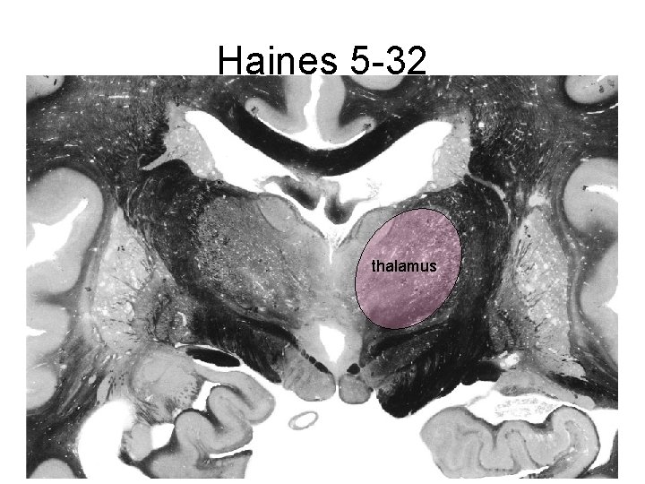 Haines 5 -32 thalamus 
