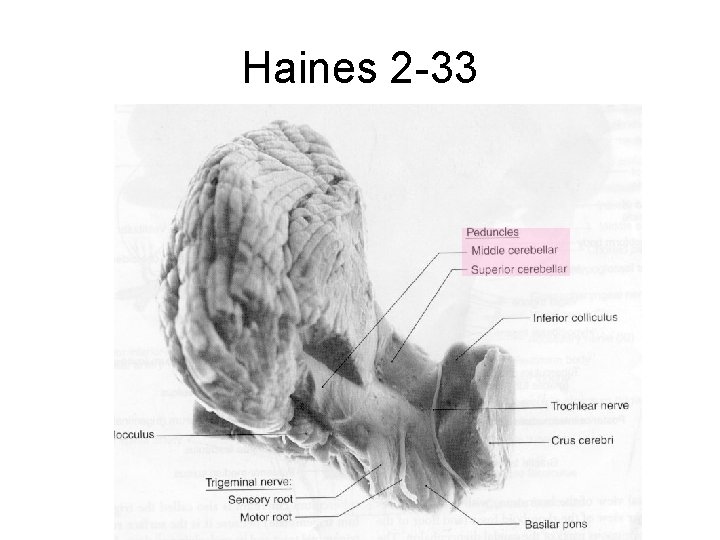 Haines 2 -33 