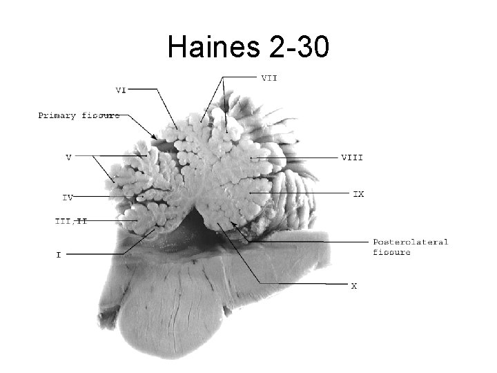 Haines 2 -30 