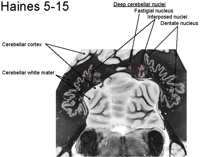 Haines 5 -15 Cerebellar cortex Cerebellar white mater Deep cerebellar nuclei Fastigial nucleus Interposed