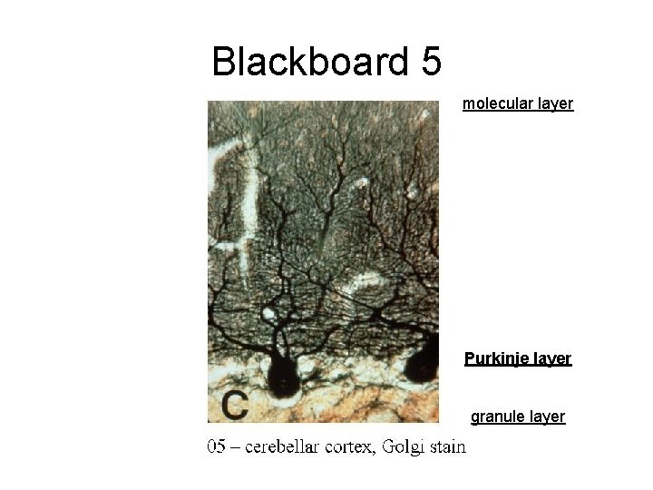Blackboard 5 molecular layer Purkinje layer granule layer 