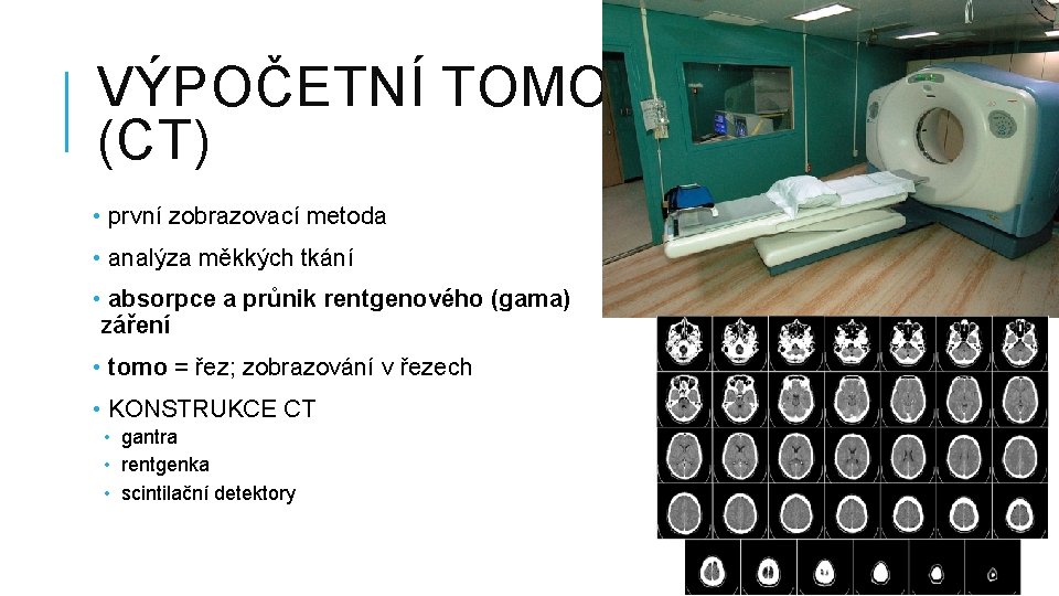 VÝPOČETNÍ TOMOGRAFIE (CT) • první zobrazovací metoda • analýza měkkých tkání • absorpce a