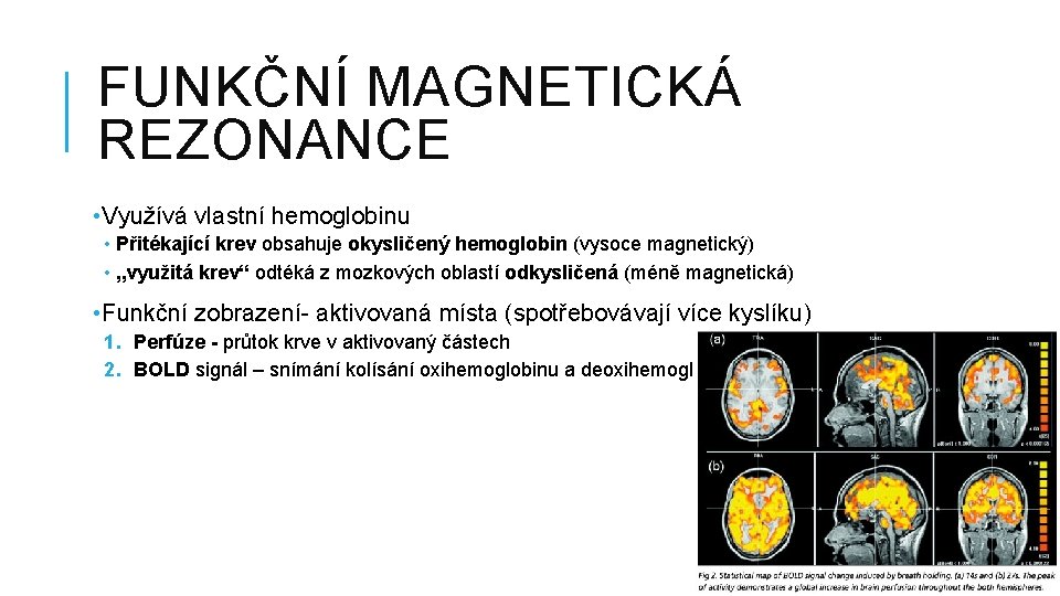 FUNKČNÍ MAGNETICKÁ REZONANCE • Využívá vlastní hemoglobinu • Přitékající krev obsahuje okysličený hemoglobin (vysoce