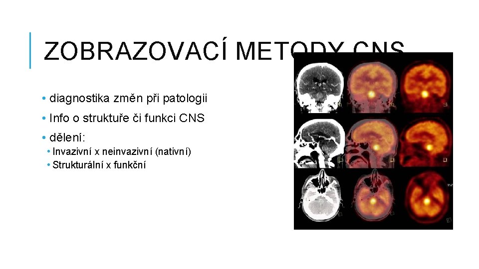 ZOBRAZOVACÍ METODY CNS • diagnostika změn při patologii • Info o struktuře či funkci