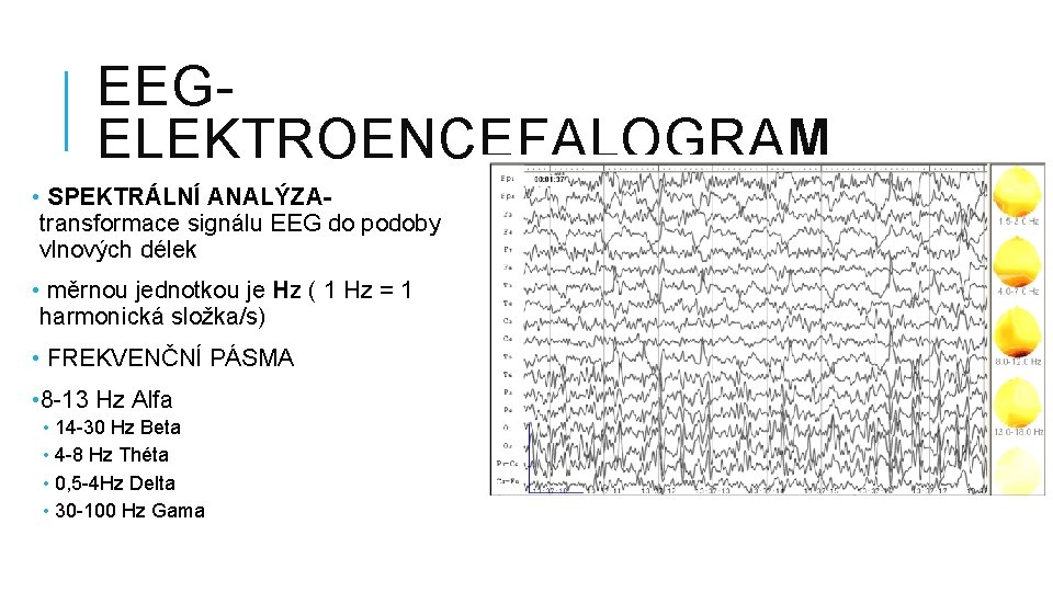 EEGELEKTROENCEFALOGRAM • SPEKTRÁLNÍ ANALÝZAtransformace signálu EEG do podoby vlnových délek • měrnou jednotkou je