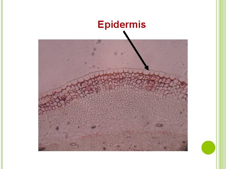 Epidermis 