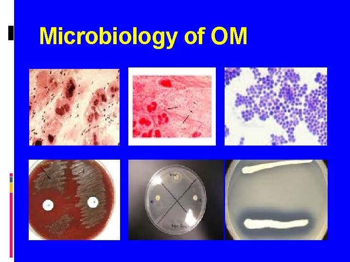 Microbiology of OM 