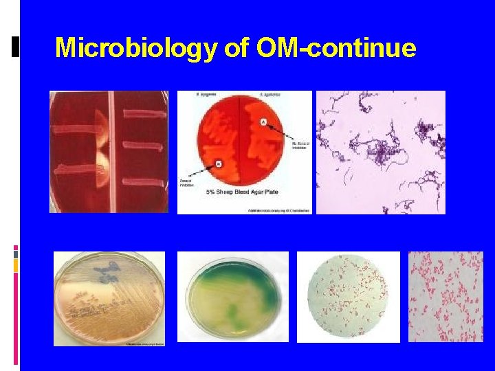 Microbiology of OM-continue 