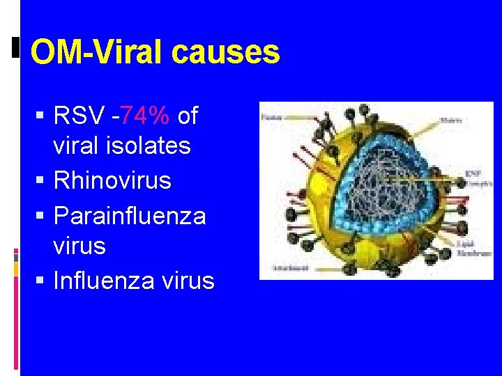 OM-Viral causes RSV -74% of viral isolates Rhinovirus Parainfluenza virus Influenza virus 