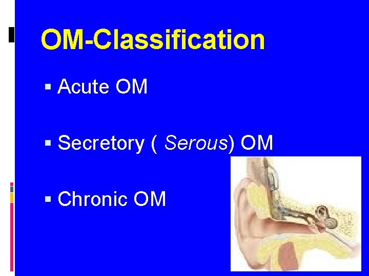 OM-Classification Acute OM Secretory ( Serous) OM Chronic OM 