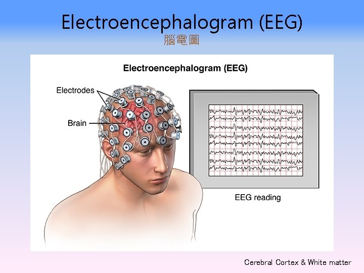Electroencephalogram (EEG) 腦電圖 Cerebral Cortex & White matter 