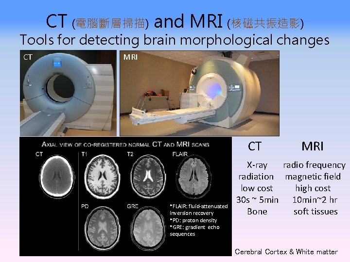 CT (電腦斷層掃描) and MRI (核磁共振造影) Tools for detecting brain morphological changes CT MRI CT