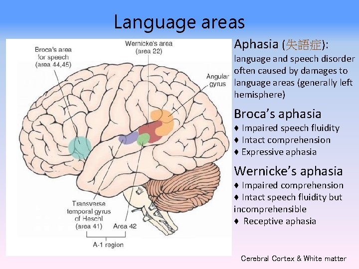 Language areas Aphasia (失語症): language and speech disorder often caused by damages to language