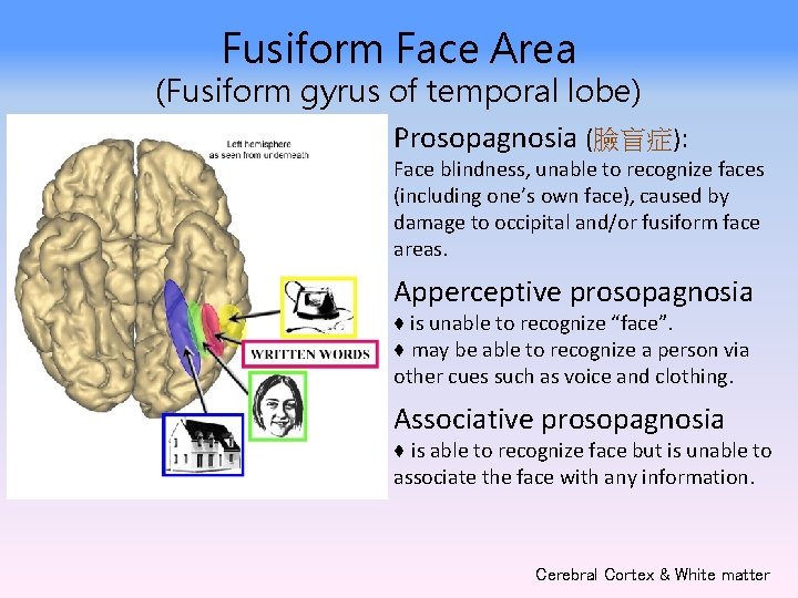 Fusiform Face Area (Fusiform gyrus of temporal lobe) Prosopagnosia (臉盲症): Face blindness, unable to