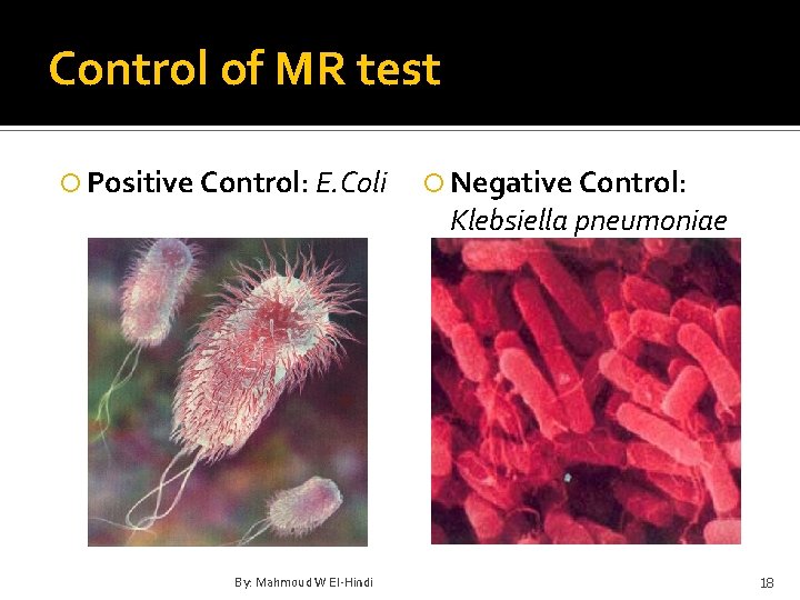 Control of MR test Positive Control: E. Coli By: Mahmoud W El-Hindi Negative Control: