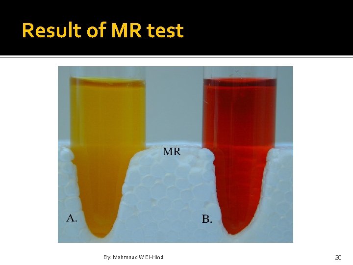 Result of MR test By: Mahmoud W El-Hindi 20 