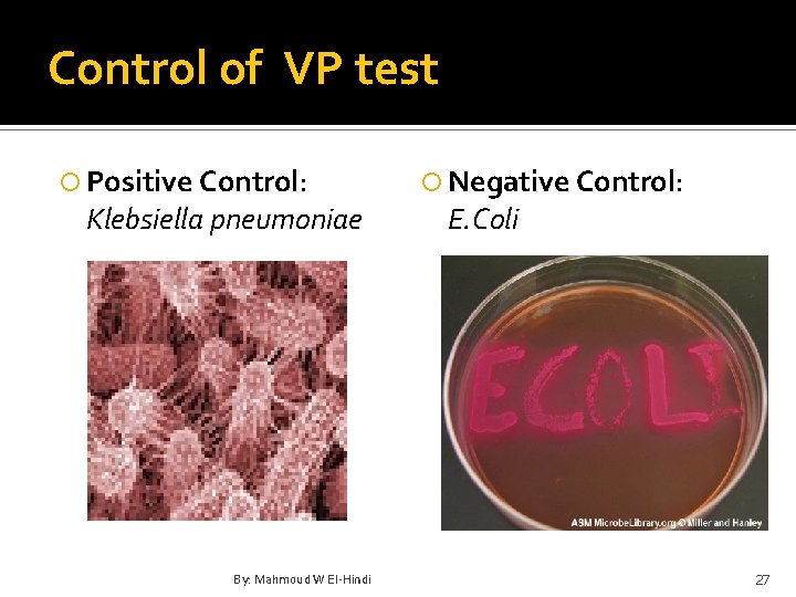 Control of VP test Positive Control: Klebsiella pneumoniae By: Mahmoud W El-Hindi Negative Control: