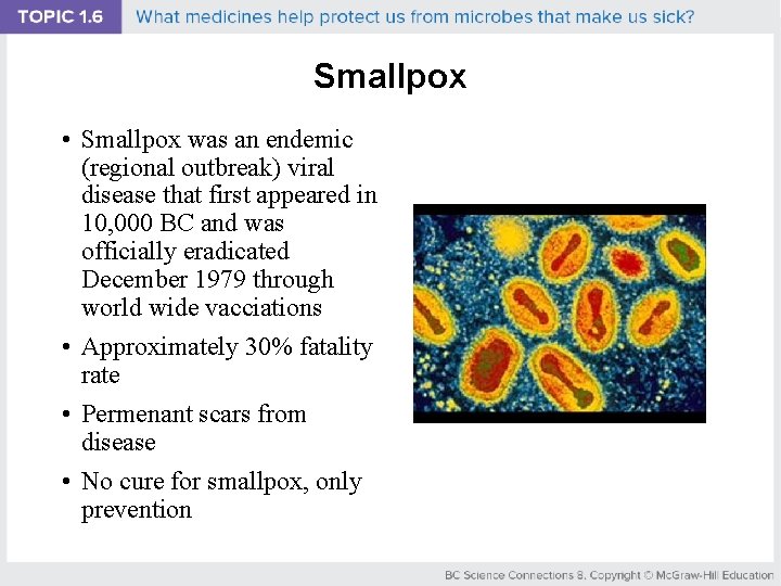 Smallpox • Smallpox was an endemic (regional outbreak) viral disease that first appeared in