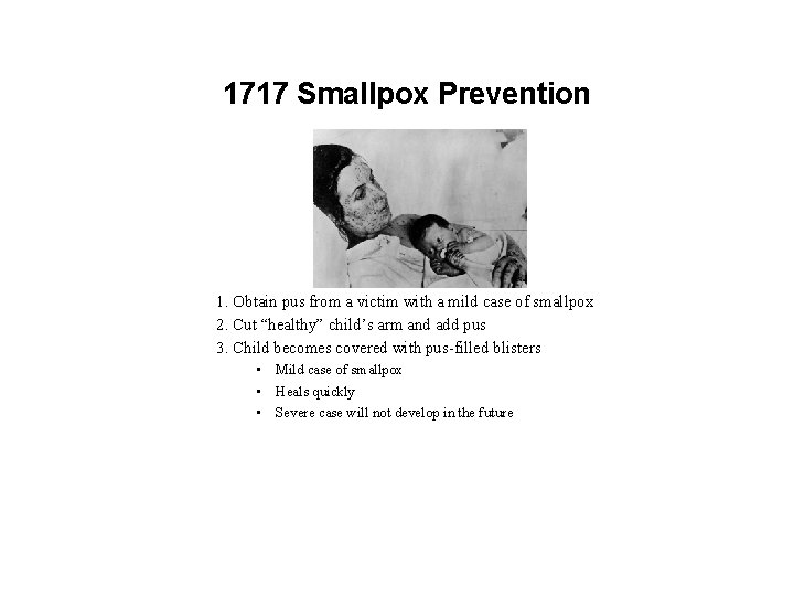 1717 Smallpox Prevention 1. Obtain pus from a victim with a mild case of