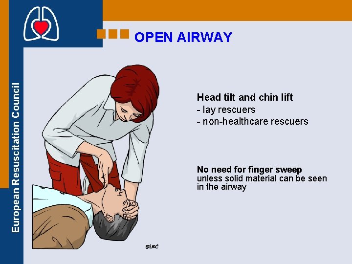 European Resuscitation Council OPEN AIRWAY Head tilt and chin lift - lay rescuers -