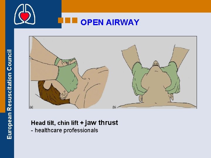 European Resuscitation Council OPEN AIRWAY Head tilt, chin lift + jaw thrust - healthcare