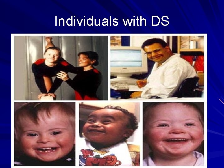 Individuals with DS 