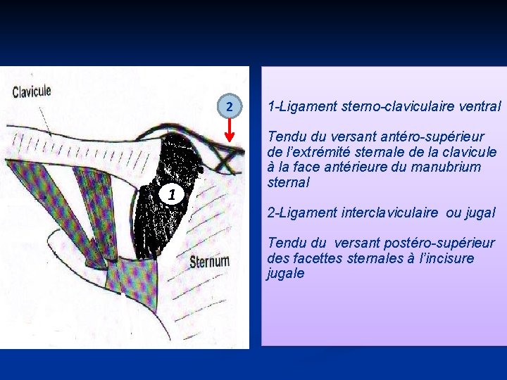 2 1 1 -Ligament sterno-claviculaire ventral Tendu du versant antéro-supérieur de l’extrémité sternale de