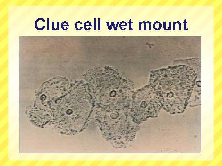 Clue cell wet mount 