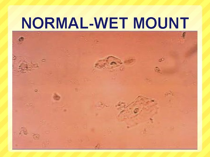 NORMAL-WET MOUNT 