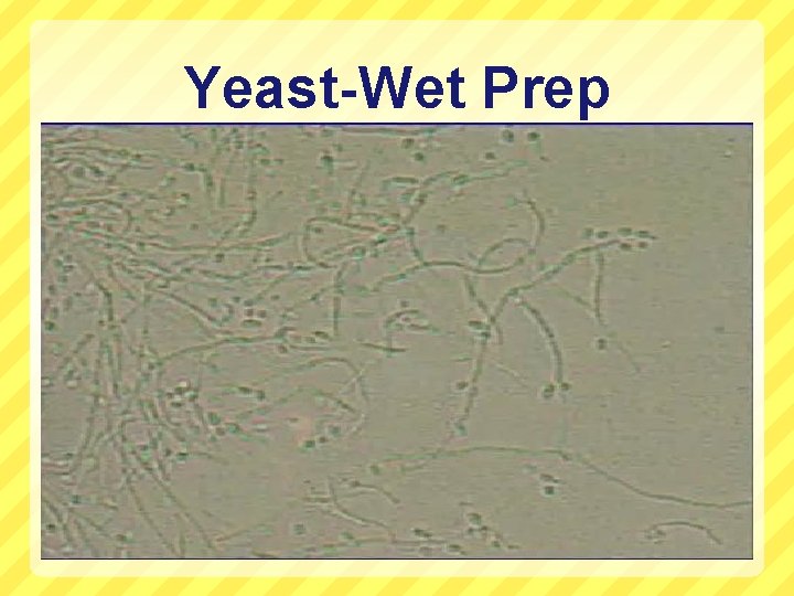 Yeast-Wet Prep 