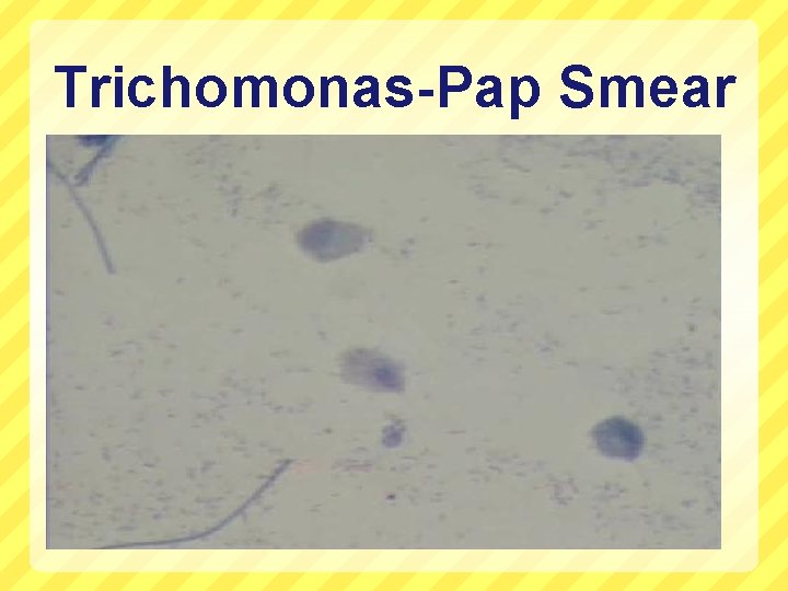 Trichomonas-Pap Smear 