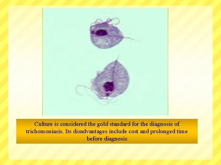 Culture is considered the gold standard for the diagnosis of trichomoniasis. Its disadvantages include