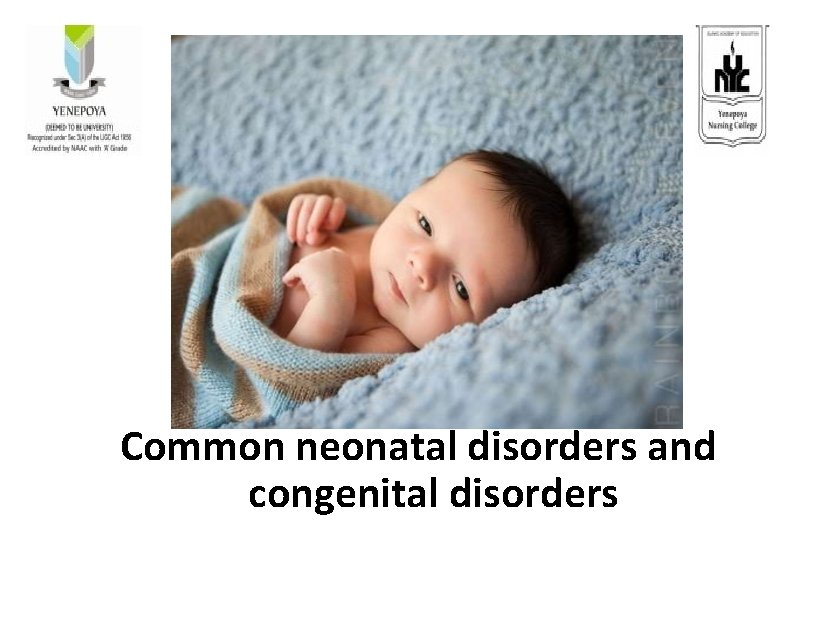 Common neonatal disorders and congenital disorders 