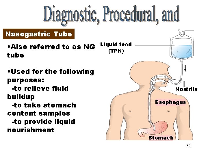 Nasogastric Tube • Also referred to as NG tube • Used for the following