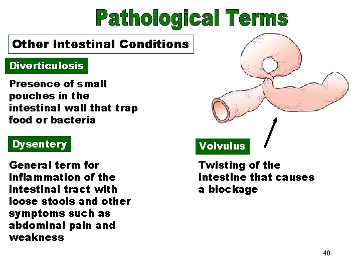 Other Intestinal Conditions Diverticulosis Presence of small pouches in the intestinal wall that trap