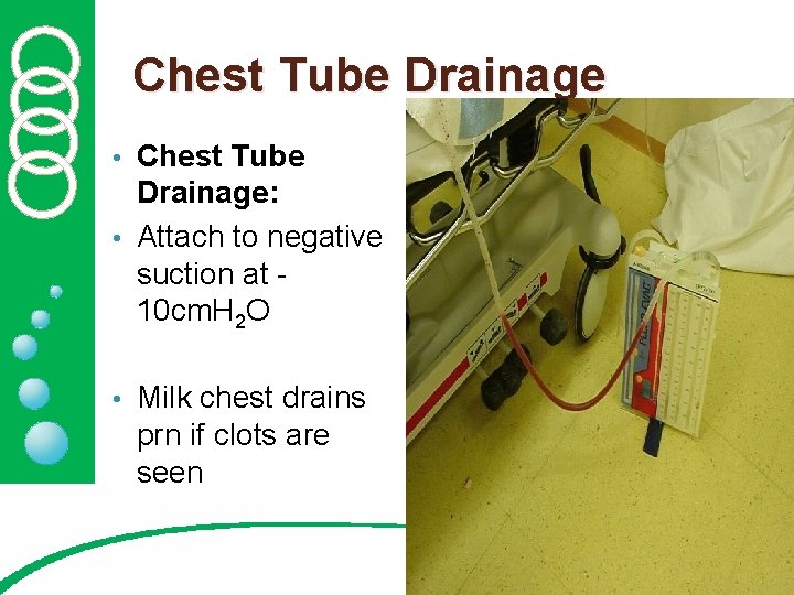 Chest Tube Drainage: • Attach to negative suction at 10 cm. H 2 O