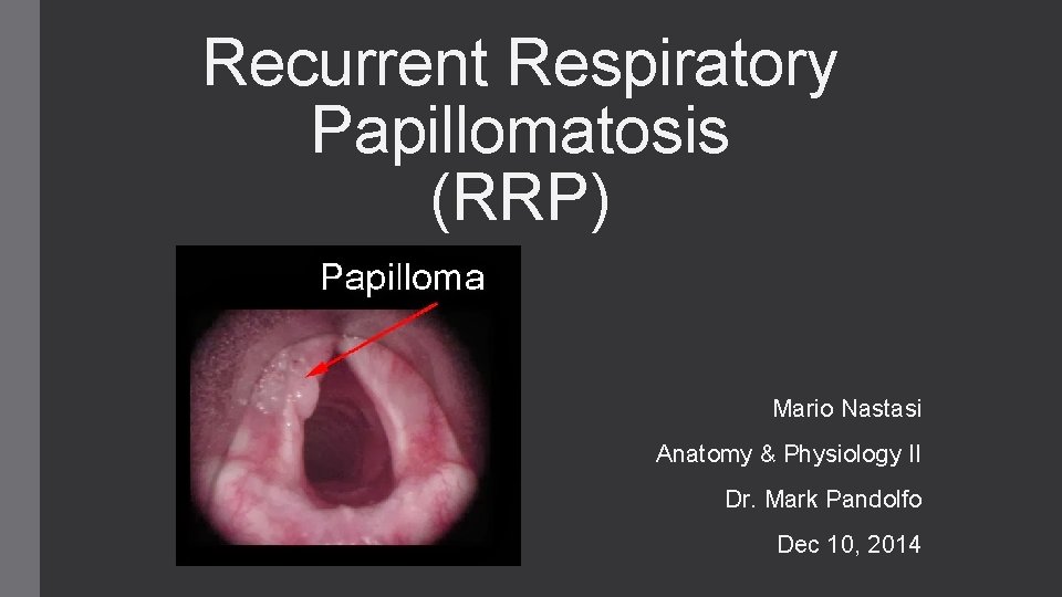 respiratory papillomatosis defined)