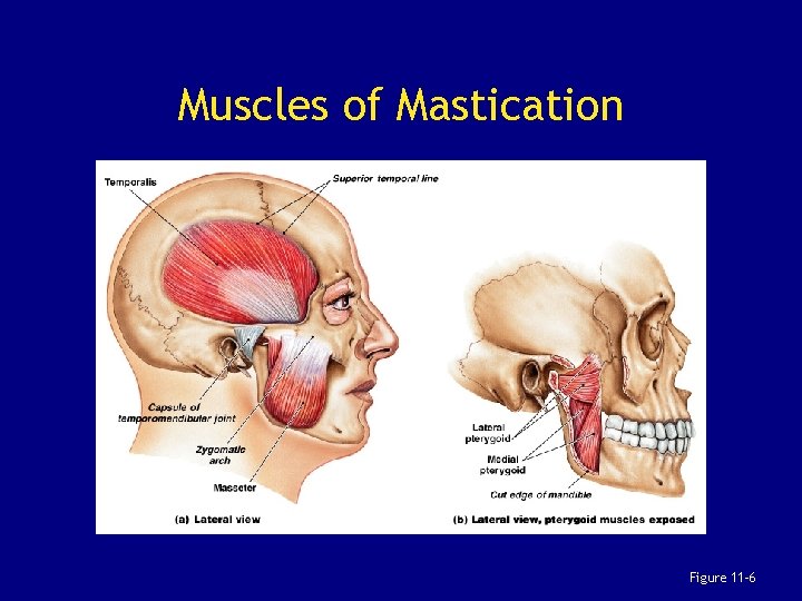 Muscles of Mastication Figure 11– 6 