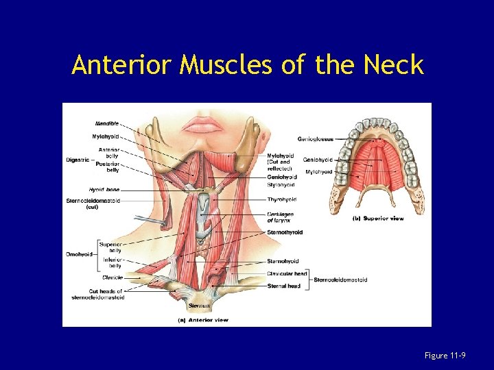 Anterior Muscles of the Neck Figure 11– 9 