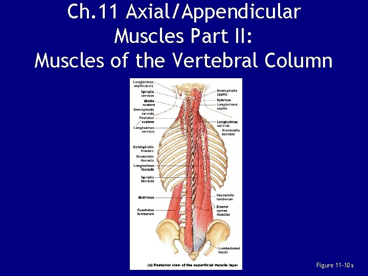 Ch. 11 Axial/Appendicular Muscles Part II: Muscles of the Vertebral Column Figure 11– 10