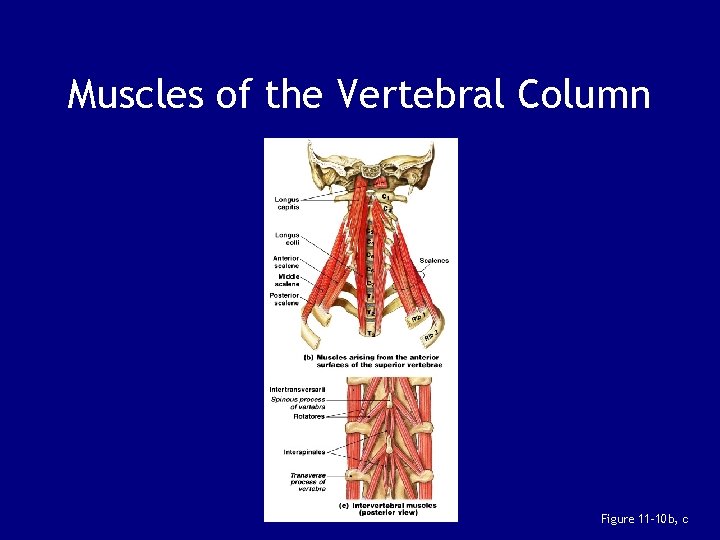 Muscles of the Vertebral Column Figure 11– 10 b, c 