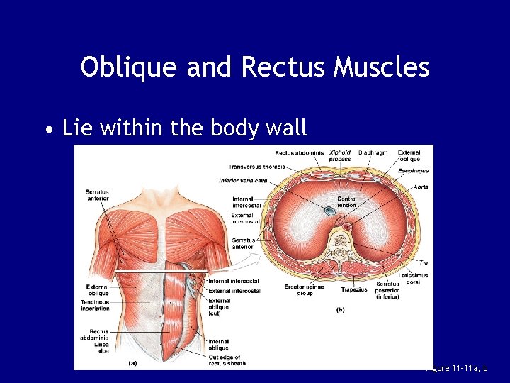 Oblique and Rectus Muscles • Lie within the body wall Figure 11– 11 a,