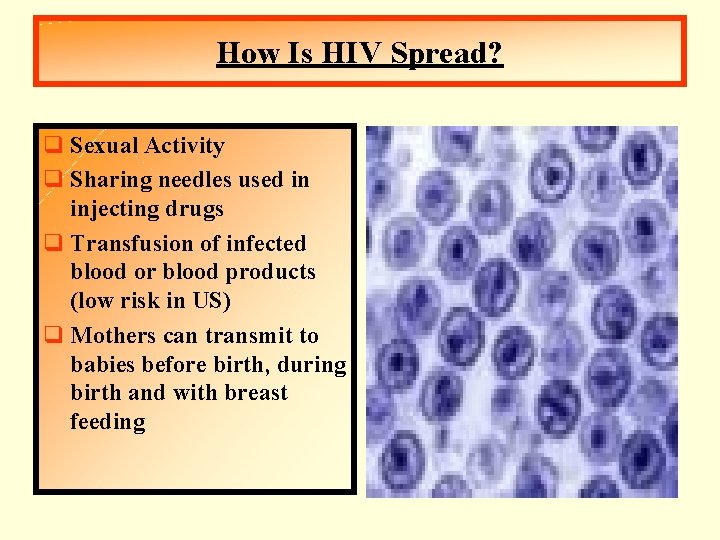 How Is HIV Spread? q Sexual Activity q Sharing needles used in injecting drugs