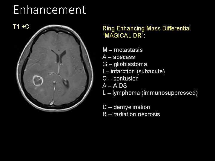 Enhancement T 1 +C Ring Enhancing Mass Differential “MAGICAL DR”: M – metastasis A